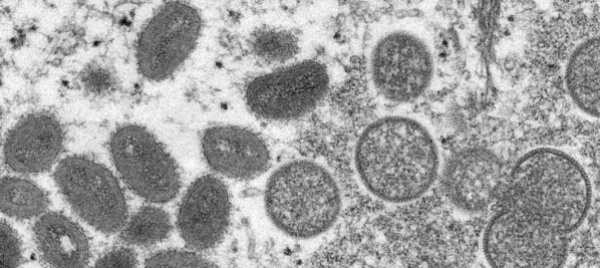 il-vaiolo-delle-scimmie-si-puo-contenere