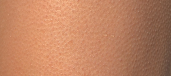 sensore-biodegradabile-sottopelle-rilevera-efficacia-farmaci