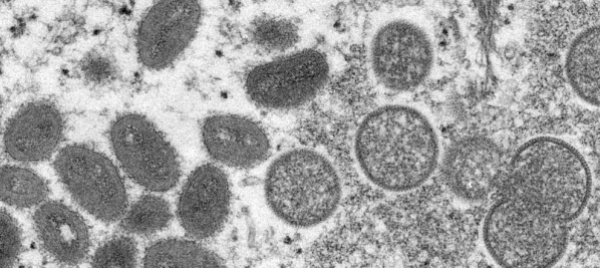 oms-il-vaiolo-delle-scimmie-non-e-ora-un-emergenza-sanitaria