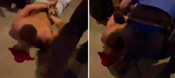 arresto-di-chiasso-l-hanno-colpito-con-un-manganello