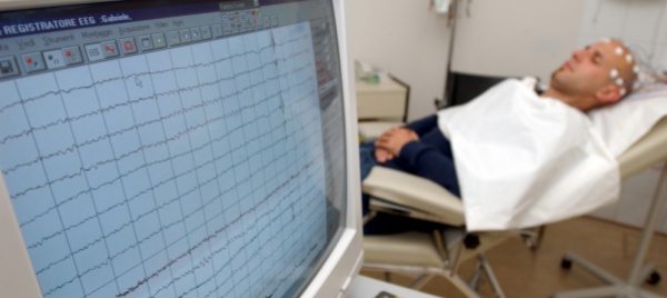 epilessia-alla-base-forse-una-iper-comunicazione-cerebrale